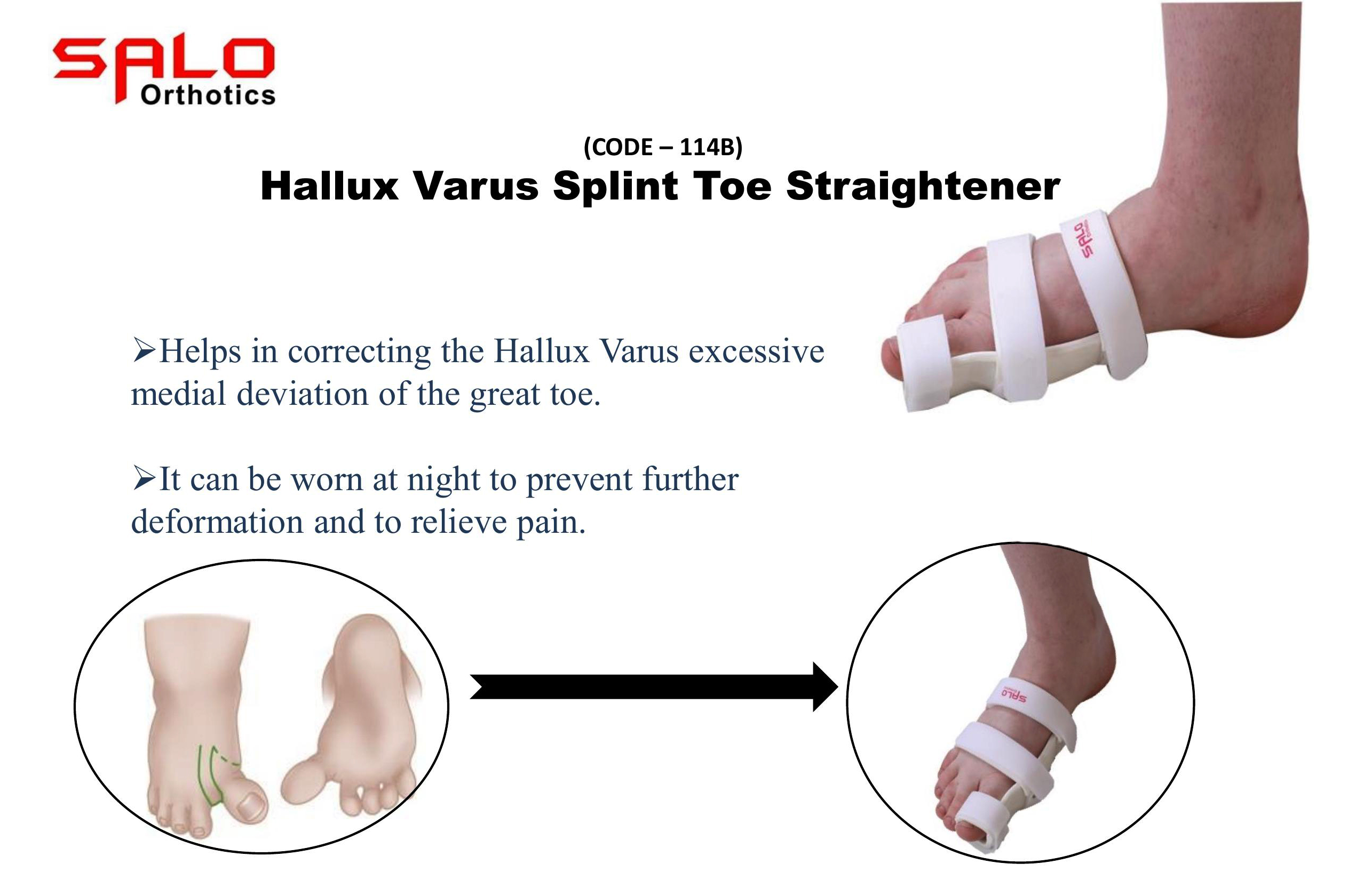 Hallux Varus Splint Toe Straightener - Image 2