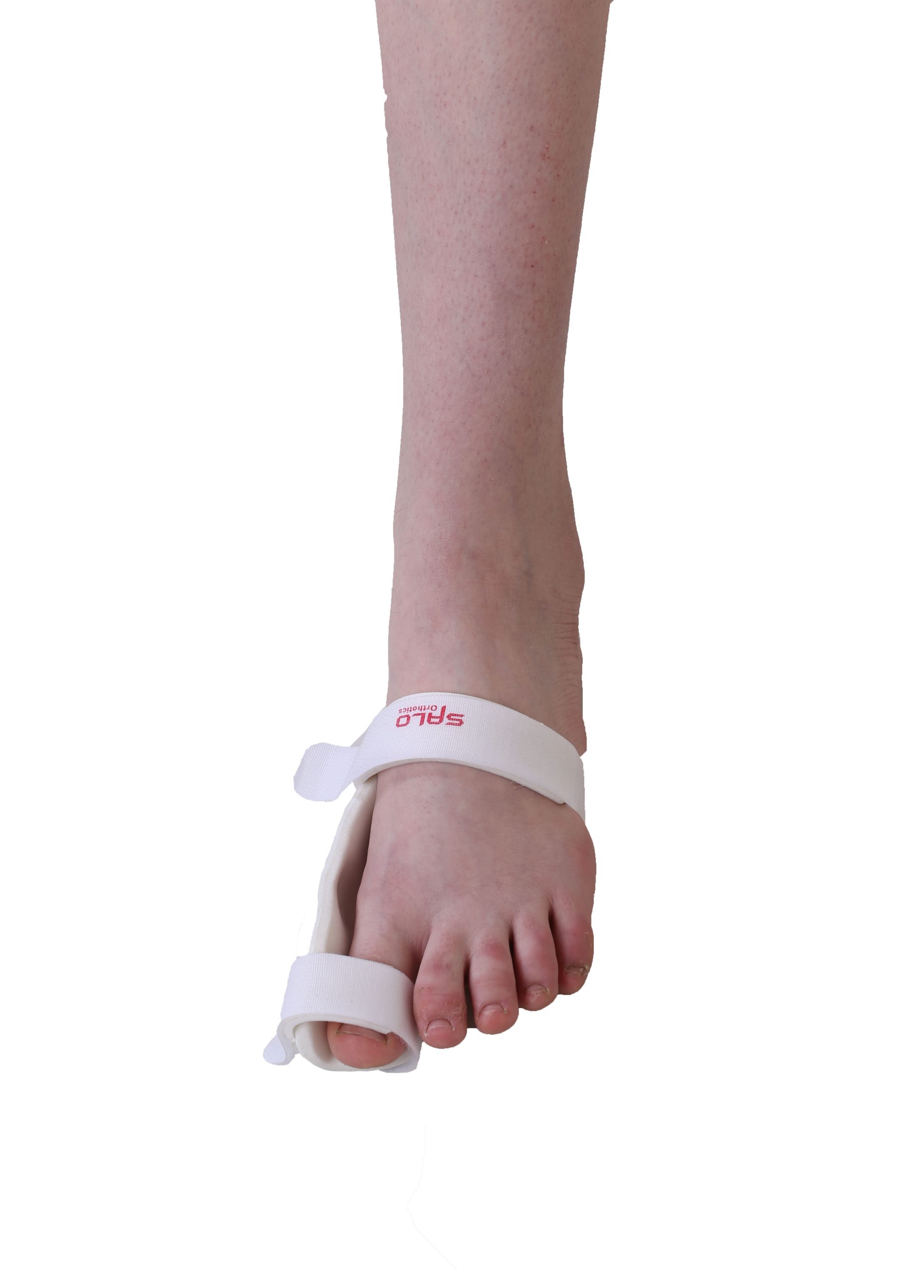 Hallux Valgus Splint (Bunion Splint) - Image 4